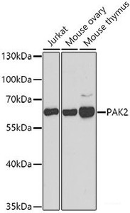 Western blot analysis of extracts of various cell lines using PAK2 Polyclonal Antibody at dilution of 1:1000.