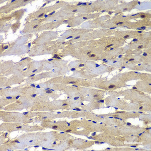 Immunohistochemistry of paraffin-embedded Rat heart using PSMB8 Polyclonal Antibody at dilution of 1:100 (40x lens) .