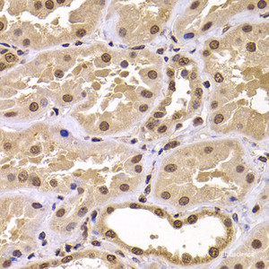 Immunohistochemistry of paraffin-embedded Human kidney using CSRP2BP Polyclonal Antibody at dilution of 1:100 (40x lens) .