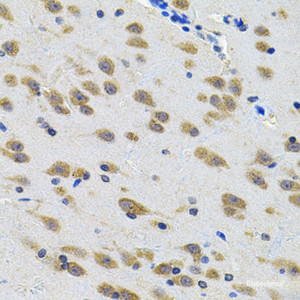 Immunohistochemistry of paraffin-embedded Rat brain using LGR6 Polyclonal Antibody at dilution of 1:100 (40x lens) .