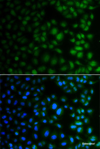 Immunofluorescence analysis of A549 cells using NAA40 Polyclonal Antibody