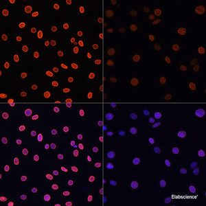 Immunofluorescence analysis of C6 cells using Acetyl-Histone H4-K91 Polyclonal Antibody at dilution of 1:100.C6 cells were treated by TSA (1 uM) at 37℃ for 18 hours. Blue: DAPI for nuclear staining.