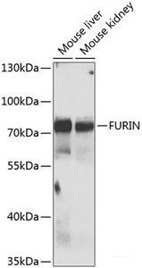 Western blot analysis of extracts of various cell lines using FURIN Polyclonal Antibody at dilution of 1:1000.