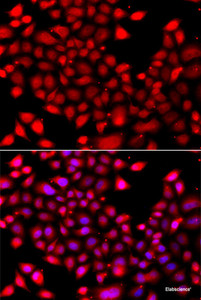 Immunofluorescence analysis of A549 cells using RARG Polyclonal Antibody