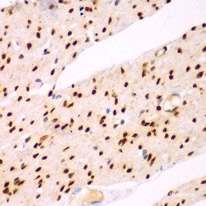 Immunohistochemistry of paraffin-embedded Human colon using TEAD3 Polyclonal Antibody at dilution of 1:100 (40x lens) .
