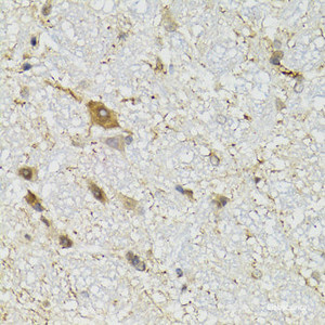 Immunohistochemistry of paraffin-embedded Mouse brain using COQ3 Polyclonal Antibody at dilution of 1:100 (40x lens) .