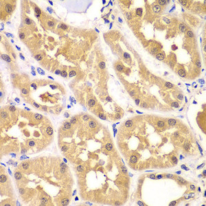 Immunohistochemistry of paraffin-embedded Human kidney using PRKAG3 Polyclonal Antibody at dilution of 1:100 (40x lens) .
