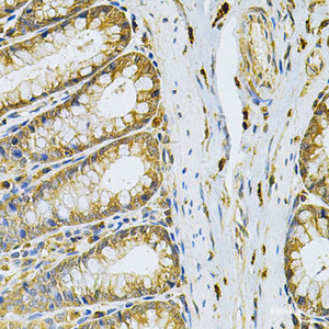 Immunohistochemistry of paraffin-embedded Rat intestine using RRAGC Polyclonal Antibody at dilution of 1:100 (40x lens) .