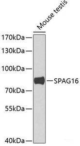 Western blot analysis of extracts of Mouse testis using SPAG16 Polyclonal Antibody at dilution of 1:1000.