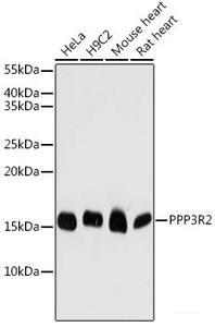 Western blot analysis of extracts of various cell lines using PPP3R2 Polyclonal Antibody at dilution of 1:1000.