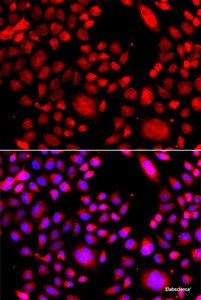 Immunofluorescence analysis of A549 cells using RAC3 Polyclonal Antibody