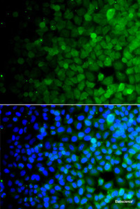 Immunofluorescence analysis of A549 cells using USP10 Polyclonal Antibody