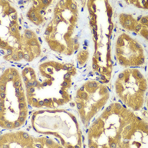 Immunohistochemistry of paraffin-embedded Human kidney using RAB1B Polyclonal Antibody at dilution of 1:100 (40x lens) .