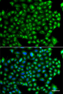 Immunofluorescence analysis of A549 cells using ZFYVE1 Polyclonal Antibody