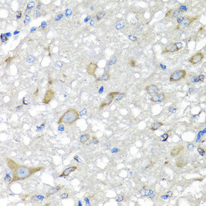 Immunohistochemistry of paraffin-embedded Rat brain using CBR3 Polyclonal Antibody at dilution of 1:100 (40x lens) .