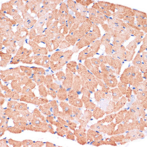 Immunohistochemistry of paraffin-embedded Rat heart using DVL2 Polyclonal Antibody at dilution of 1:100 (40x lens) .