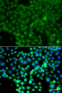 Immunofluorescence analysis of A549 cells using FRK Polyclonal Antibody