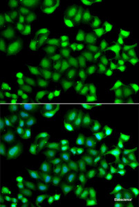 Immunofluorescence analysis of A549 cells using MAPKAPK3 Polyclonal Antibody