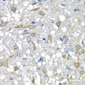 Immunohistochemistry of paraffin-embedded Rat brain using C1GALT1C1 Polyclonal Antibody at dilution of 1:100 (40x lens) .