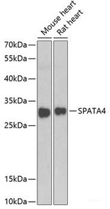 Western blot analysis of extracts of various cell lines using SPATA4 Polyclonal Antibody at dilution of 1:1000.