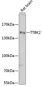 Western blot analysis of extracts of Rat brain using TTBK2 Polyclonal Antibody at dilution of 1:1000.