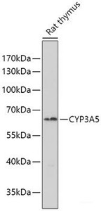 Western blot analysis of extracts of Rat thymus using CYP3A5 Polyclonal Antibody at dilution of 1:1000.