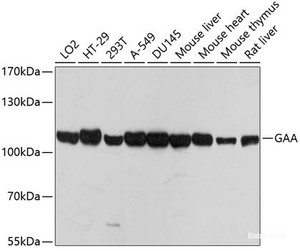 Western blot analysis of extracts of various cell lines using GAA Polyclonal Antibody at dilution of 1:1000.