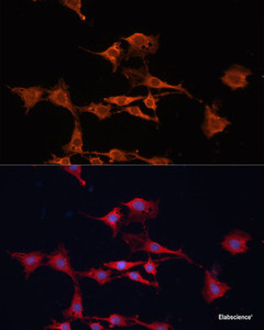 Immunofluorescence analysis of C6 cells using GSTM3 Polyclonal Antibody at dilution of 1:100. Blue: DAPI for nuclear staining.