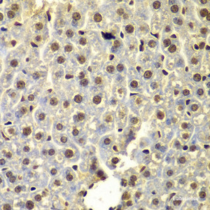 Immunohistochemistry of paraffin-embedded Mouse liver using SSX5 Polyclonal Antibody at dilution of 1:100 (40x lens) .