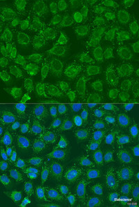 Immunofluorescence analysis of U2OS cells using PIP5K1B Polyclonal Antibody at dilution of 1:100. Blue: DAPI for nuclear staining.