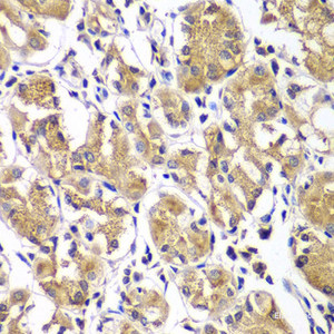 Immunohistochemistry of paraffin-embedded Human gastric using DGKE Polyclonal Antibody at dilution of 1:100 (40x lens) .