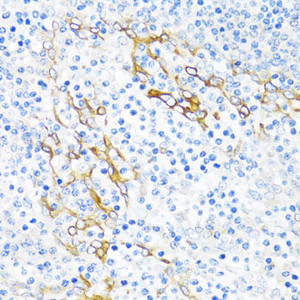 Immunohistochemistry of paraffin-embedded Human tonsil using PLA2G4C Polyclonal Antibody at dilution of 1:100 (40x lens) .