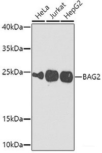 Western blot analysis of extracts of various cell lines using BAG2 Polyclonal Antibody at dilution of 1:1000.