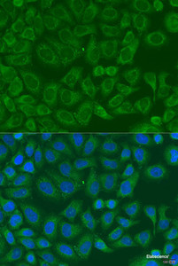 Immunofluorescence analysis of U2OS cells using ICK Polyclonal Antibody at dilution of 1:100. Blue: DAPI for nuclear staining.