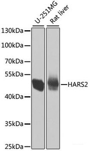 Western blot analysis of extracts of various cell lines using HARS2 Polyclonal Antibody at dilution of 1:1000.