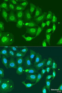 Immunofluorescence analysis of U2OS cells using MLH3 Polyclonal Antibody at dilution of 1:100. Blue: DAPI for nuclear staining.