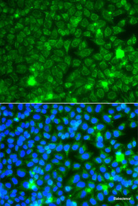 Immunofluorescence analysis of A549 cells using GBA3 Polyclonal Antibody