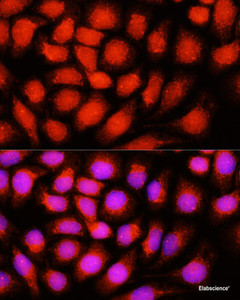 Immunofluorescence analysis of HeLa cells using ACADVL Polyclonal Antibody at dilution of 1:100 (40x lens) . Blue: DAPI for nuclear staining.