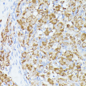 Immunohistochemistry of paraffin-embedded Rat ovary using ACAT2 Polyclonal Antibody at dilution of 1:100 (40x lens) .