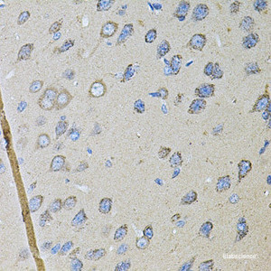 Immunohistochemistry of paraffin-embedded Rat brain using CDH16 Polyclonal Antibody at dilution of 1:100 (40x lens) .