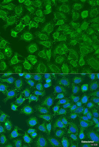 Immunofluorescence analysis of U2OS cells using EIF2B1 Polyclonal Antibody at dilution of 1:100. Blue: DAPI for nuclear staining.