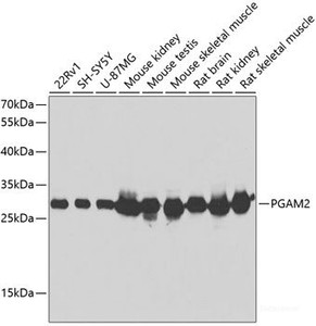 Western blot analysis of extracts of various cell lines using PGAM2 Polyclonal Antibody at dilution of 1:1000.