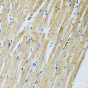 Immunohistochemistry of paraffin-embedded Rat heart using ADAM12 Polyclonal Antibody at dilution of 1:100 (40x lens) .