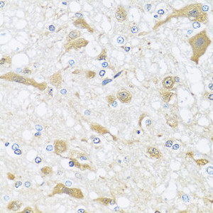 Immunohistochemistry of paraffin-embedded Rat brain using APOL1 Polyclonal Antibody at dilution of 1:100 (40x lens) .