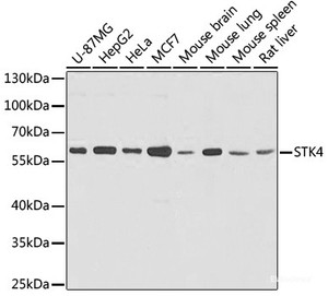 Western blot analysis of extracts of various cells using STK4 Polyclonal Antibody at dilution of 1:1000.