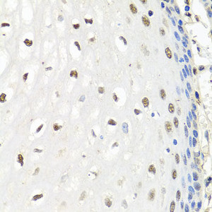 Immunohistochemistry of paraffin-embedded Human esophagus using CNOT8 Polyclonal Antibody at dilution of 1:100 (40x lens) .