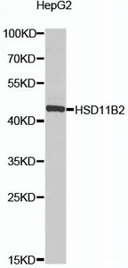 Western blot analysis of extracts of HepG2 cells using HSD11B2 Polyclonal Antibody at dilution of 1:1000.