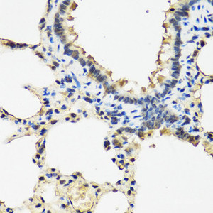 Immunohistochemistry of paraffin-embedded Rat lung using ARSF Polyclonal Antibody at dilution of 1:100 (40x lens) .