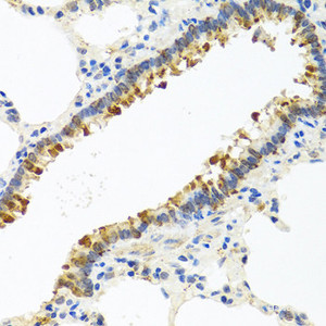 Immunohistochemistry of paraffin-embedded Rat lung using CST4 Polyclonal Antibody at dilution of 1:100 (40x lens) .