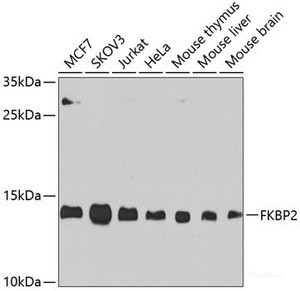 Western blot analysis of extracts of various cell lines using FKBP2 Polyclonal Antibody at dilution of 1:1000.